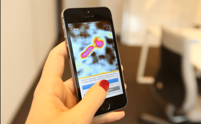 Skin cancer detection app gets $3.4 million in funding